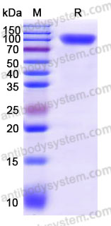 AHD48402, SDS-PAGE