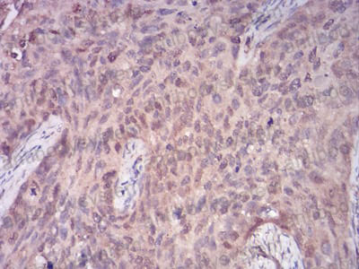 Валидация AntibodySystem RHD32603 (1490)