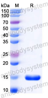 Валидация SDS-PAGE - AntibodySystem RXX05904