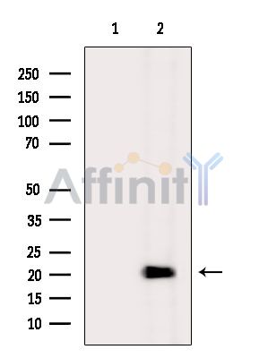 Валидация Affinity DF14006 - 9764