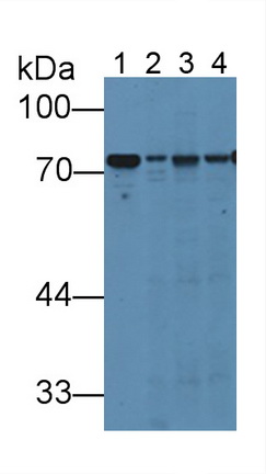 12014