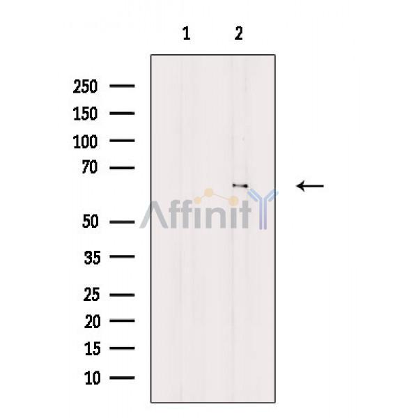 Валидация Affinity DF8672 - 20641
