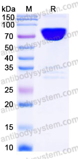 EHJ27702, SDS-PAGE
