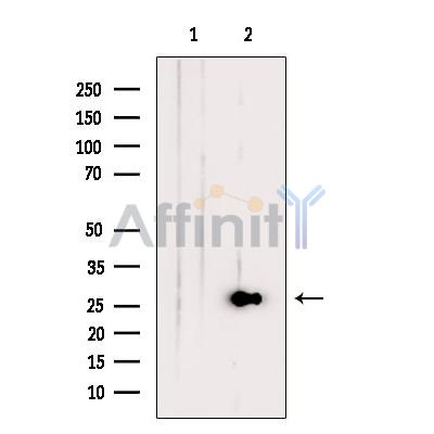 Валидация Affinity DF13357 - 8573