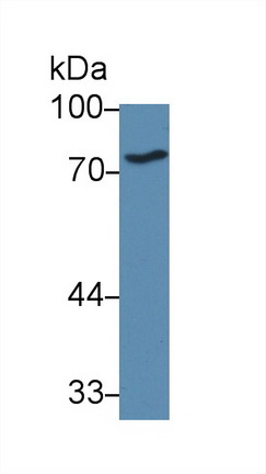 12817