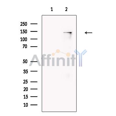 Валидация Affinity DF13358 - 8575
