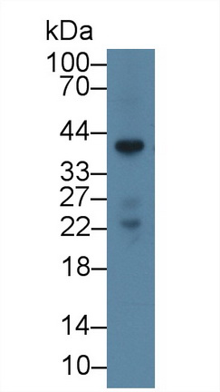 14717