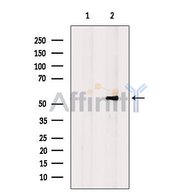 Валидация Affinity DF9215 - 21619