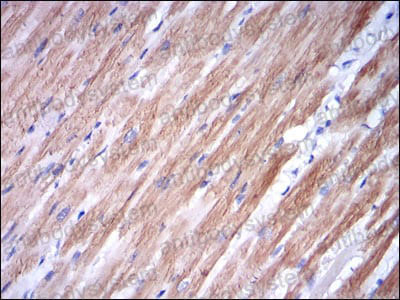 Валидация AntibodySystem RHE61803 (2242)