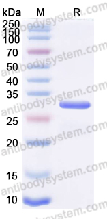 YHF62601, SDS-PAGE