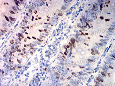 Валидация AntibodySystem RHC88302