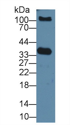 17666