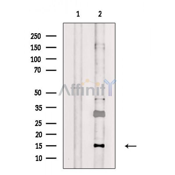 Валидация Affinity DF2383 - 12970