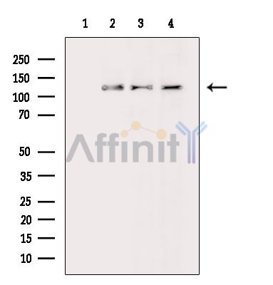Валидация Affinity DF8746 - 20757