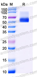 EHE01904, SDS-PAGE