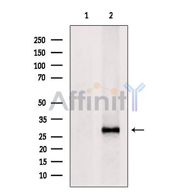 Валидация Affinity DF6408 - 17771