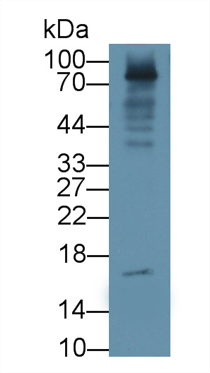 25348