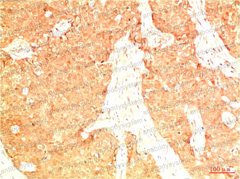 Валидация AntibodySystem RHC10011 (624)