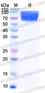 AHC97401, SDS-PAGE