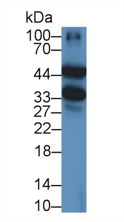 14664