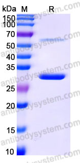 YHG42802, SDS-PAGE