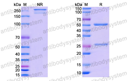 Валидация SDS-PAGE - AntibodySystem RHJ92806