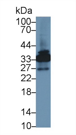13314