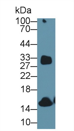 12339