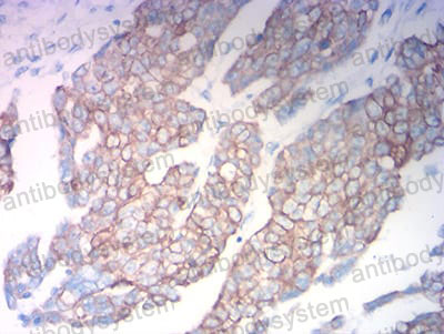 Валидация AntibodySystem RHC17803