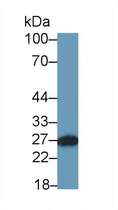 21183