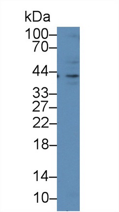 13524