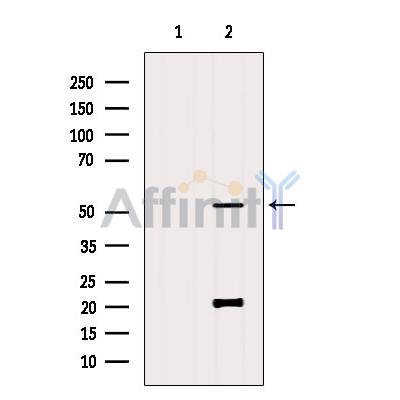Валидация Affinity DF8547 - 20436