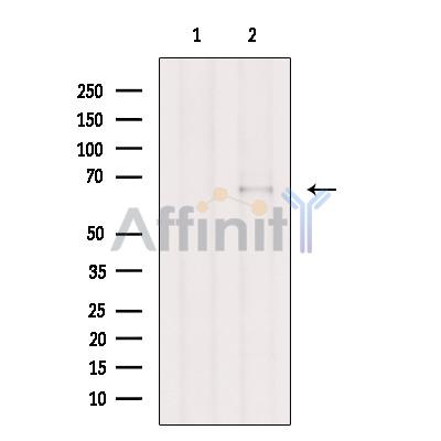 Валидация Affinity DF8932 - 21080