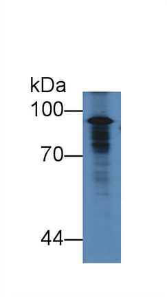 17613