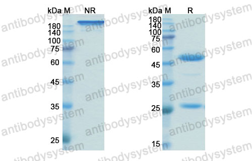 Валидация SDS-PAGE - AntibodySystem DHB90008
