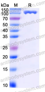 EHJ42802, SDS-PAGE