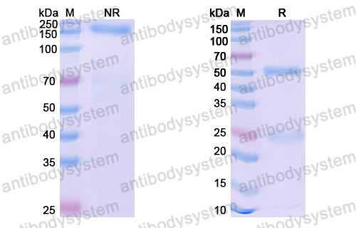 Валидация SDS-PAGE - AntibodySystem DHJ04006