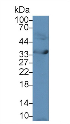 15257