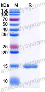 Валидация SDS-PAGE - AntibodySystem RHD68901