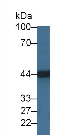 14307