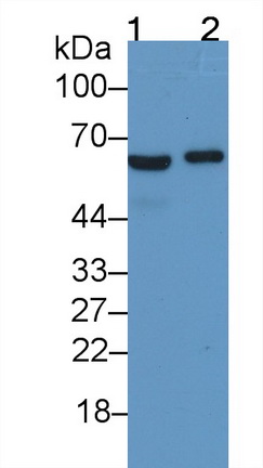 61254
