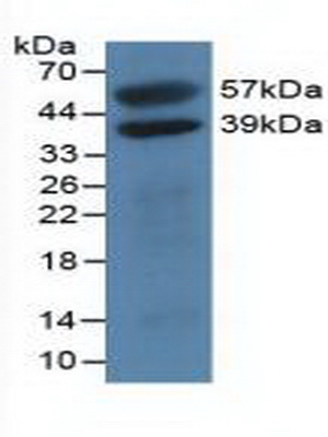 51760