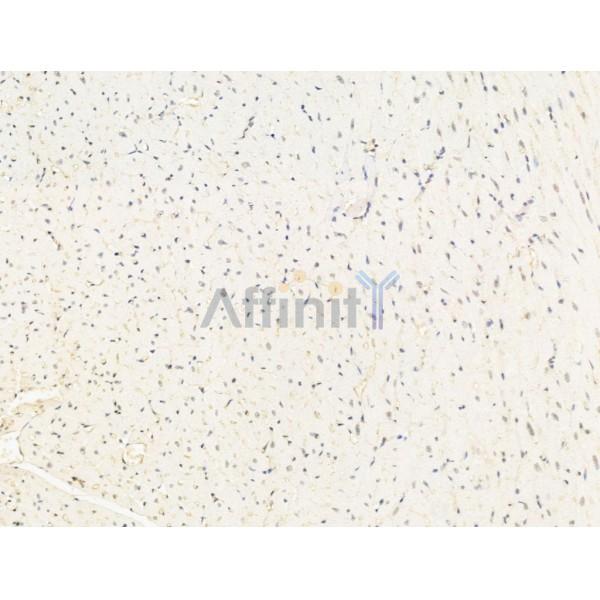 Валидация Affinity DF13613 - 9124