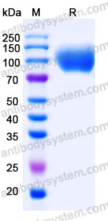 AHJ51601, SDS-PAGE