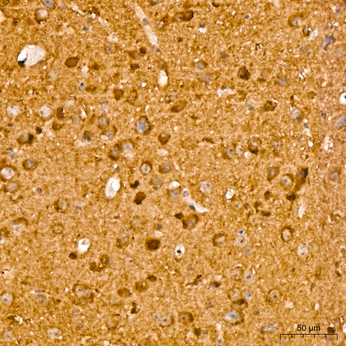 AP1445, иммуногистохимия, ткань мозга мыши (25458)