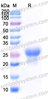 EHE70202, SDS-PAGE
