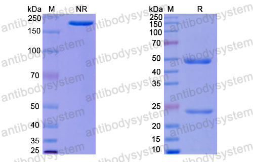 Валидация SDS-PAGE - AntibodySystem RHJ93001