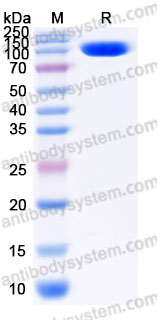 EHD47902, SDS-PAGE