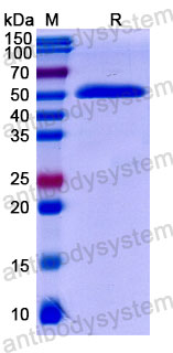 Валидация SDS-PAGE - AntibodySystem DGK07806