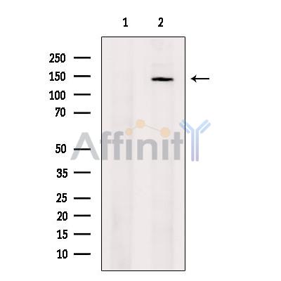 Валидация Affinity DF13416 - 8711